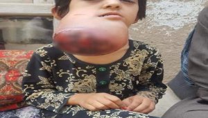 Afganistanlı küçük Habibe yardım bekliyor
