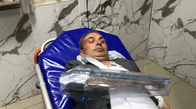 CHP'li Belediye Başkan Yardımcısına saldırı anı güvenlik kamerasında 