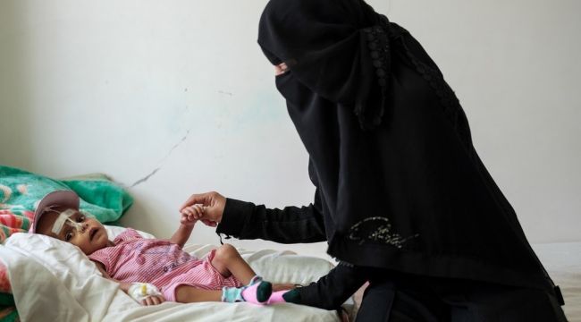 "Yemen'de 7,4 milyon çocuk yetersiz besleniyor"