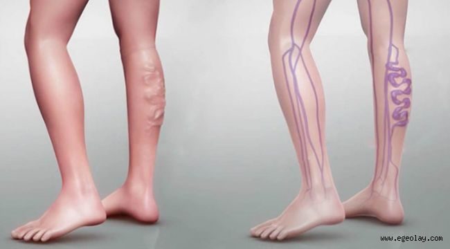 Varisi Tetikleyen 5 Önemli Faktör 