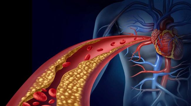 Damar Hastalıklarına Erken Müdahale Damar Check-up'ı