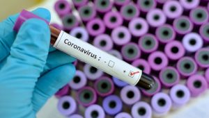 Özel sağlık sigortası poliçeleri corona virüste tedavi giderlerini kapsıyor mu?