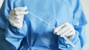 Hastanelerde tarama amaçlı PCR testi uygulaması kaldırıldı